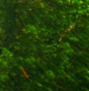 广东癫痫医院那家好