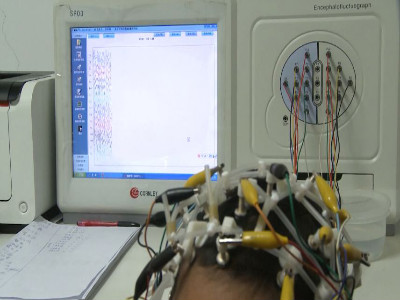 黑龙江中亚医院癫痫精准诊断的重要手段——长程视频脑电图监测的应用